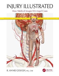 Abbildung von: Injury Illustrated - CRC Press
