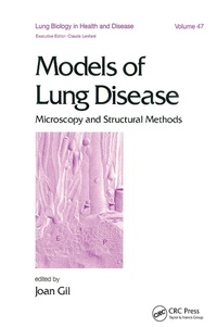 Abbildung von: Models of Lung Disease - CRC Press