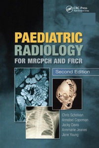 Abbildung von: Paediatric Radiology for MRCPCH and FRCR, Second Edition - CRC Press