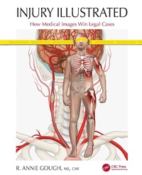 Abbildung von: Injury Illustrated - CRC Press