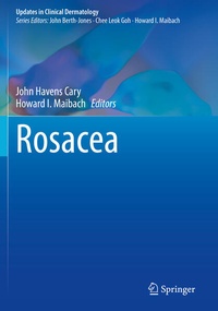 Enlarge image Cover: Rosacea - Springer