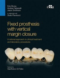 Abbildung von: Fixed prosthesis with vertical margin closure - EDRA Publications LLC