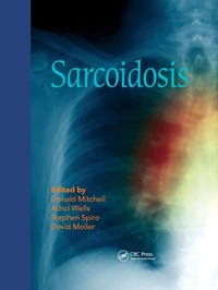 Enlarge image Cover: Sarcoidosis - CRC Press
