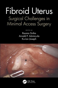 Abbildung von: Fibroid Uterus - CRC Press
