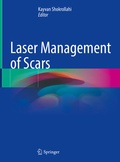Cover: Laser Management of Scars - Springer