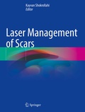 Cover: Laser Management of Scars - Springer