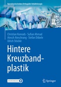 Cover: Hintere Kreuzbandplastik - Springer