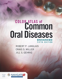 Abbildung von: Color Atlas of Common Oral Diseases, Enhanced Edition - Jones and Bartlett Publishers, Inc