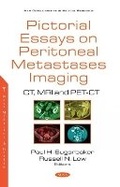 Cover: Pictorial Essays on Peritoneal Metastases Imaging - Nova Science Publishers Inc