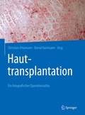 Cover: Hauttransplantation - Springer
