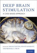 Abbildung von: Deep Brain Stimulation - OUP eBook