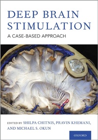 Abbildung von: Deep Brain Stimulation - OUP eBook