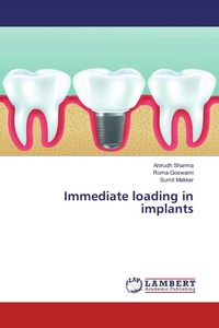 Enlarge image Cover: Immediate loading in implants - LAP Lambert Academic Publishing