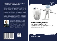 Abbildung von: Jendodonticheskoe lechenie zubow s nepolnym rizogenezom - Sciencia Scripts