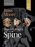 Cover: Diagnostic Imaging: Spine - Elsevier