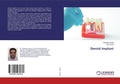 Cover: Dental Implant - LAP Lambert Academic Publishing
