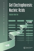 Cover: Gel Electrophoresis: Nucleic Acids - Taylor & Francis