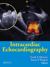 Abbildung von: Intracardiac Echocardiography - CRC Press