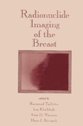 Cover: Radionuclide Imaging of the Breast - CRC Press