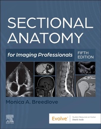 Abbildung von: Sectional Anatomy for Imaging Professionals - Elsevier