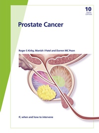 Enlarge image Cover: Fast Facts: Prostate Cancer - S. Karger