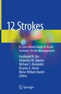 Abbildung von: 12 Strokes - Springer