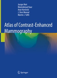 Abbildung von: Atlas of Contrast-Enhanced Mammography - Springer
