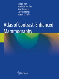 Abbildung von: Atlas of Contrast-Enhanced Mammography - Springer