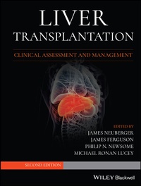 Abbildung von: Liver Transplantation - Wiley