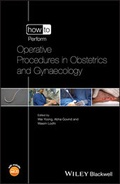 Cover: How to Perform Operative Procedures in Obstetrics and Gynaecology - Wiley