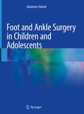 Cover: Foot and Ankle Surgery in Children and Adolescents - Springer