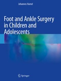 Cover: Foot and Ankle Surgery in Children and Adolescents - Springer