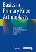 Cover: Basics in Primary Knee Arthroplasty - Springer