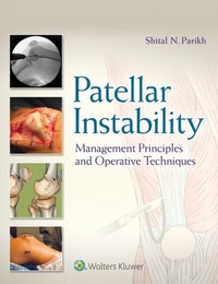 Abbildung von: Patellar Instability - Wolters Kluwer Health