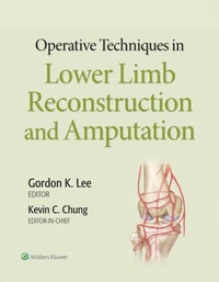 Abbildung von: Operative Techniques in Lower Limb Reconstruction and Amputation - Wolters Kluwer Health