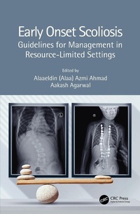 Abbildung von: Early Onset Scoliosis - CRC Press