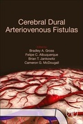 Cover: Cerebral Dural Arteriovenous Fistulas - Academic Press