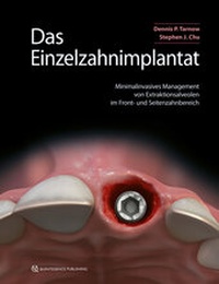 Abbildung von: Das Einzelzahnimplantat - Quintessenz Verlag