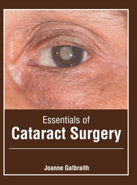 Enlarge image Cover: Essentials of Cataract Surgery - Foster Academics