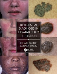 Abbildung von: Differential Diagnosis in Dermatology - CRC Press