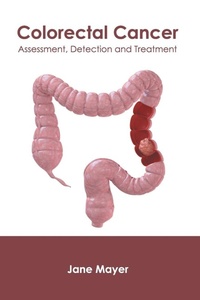 Enlarge image Cover: Colorectal Cancer: Assessment, Detection and Treatment - Foster Academics