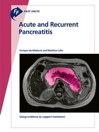 Abbildung von: Fast Facts: Acute and Recurrent Pancreatitis - S. Karger