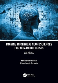 Abbildung von: Imaging in Clinical Neurosciences for Non-radiologists - CRC Press