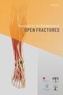Cover: Standards for the Management of Open Fractures - OUP eBook