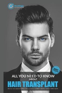 Abbildung von: All You Need to Know about Hair Transplant - Pasquale Minasi