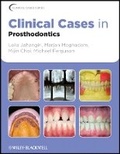 Cover: Clinical Cases in Prosthodontics - Wiley