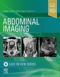Abbildung von: Abdominal Imaging - Elsevier