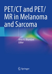 Abbildung von: PET/CT and PET/MR in Melanoma and Sarcoma - Springer