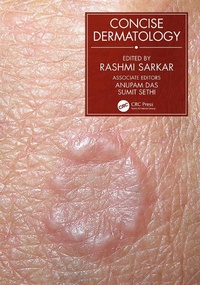 Abbildung von: Concise Dermatology - CRC Press