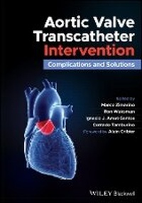 Enlarge image Cover: Aortic Stenosis Percutaneous Intervention - Wiley